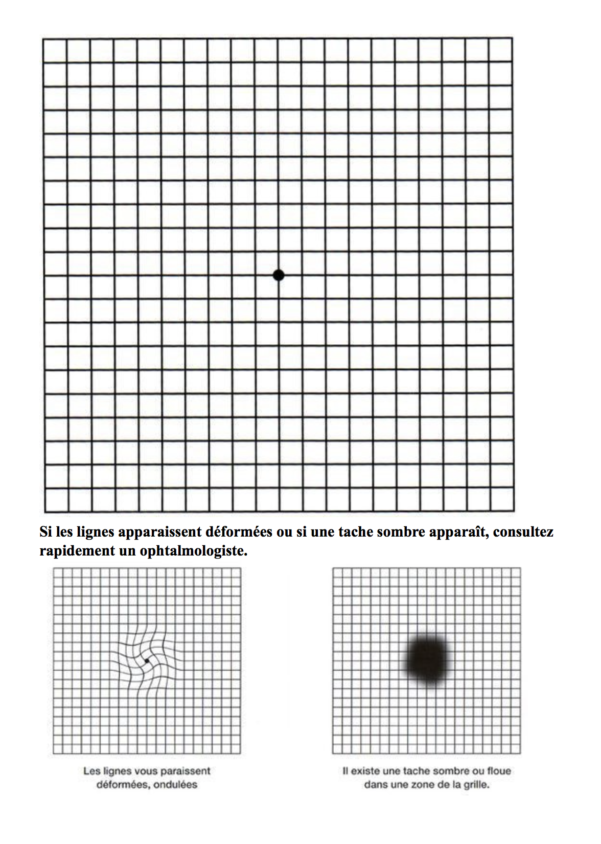 Si les lignes apparaissent déformées ou si une tache sombre apparaît, consultez rapidement un ophtalmologiste.